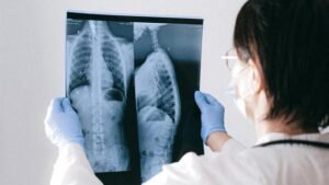 Tos crónica en México afecta a uno de cada diez adultos